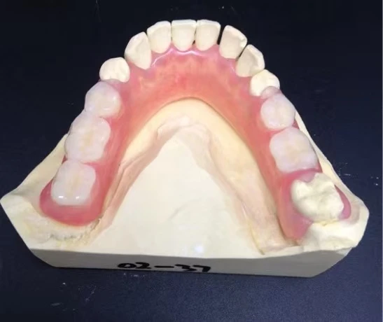歯科 RPD バルプラスト義歯工場